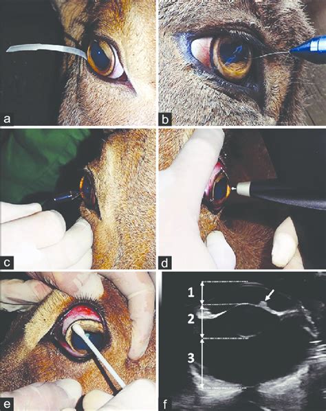 tonometry schiermer tear test|tonometry before dilation.